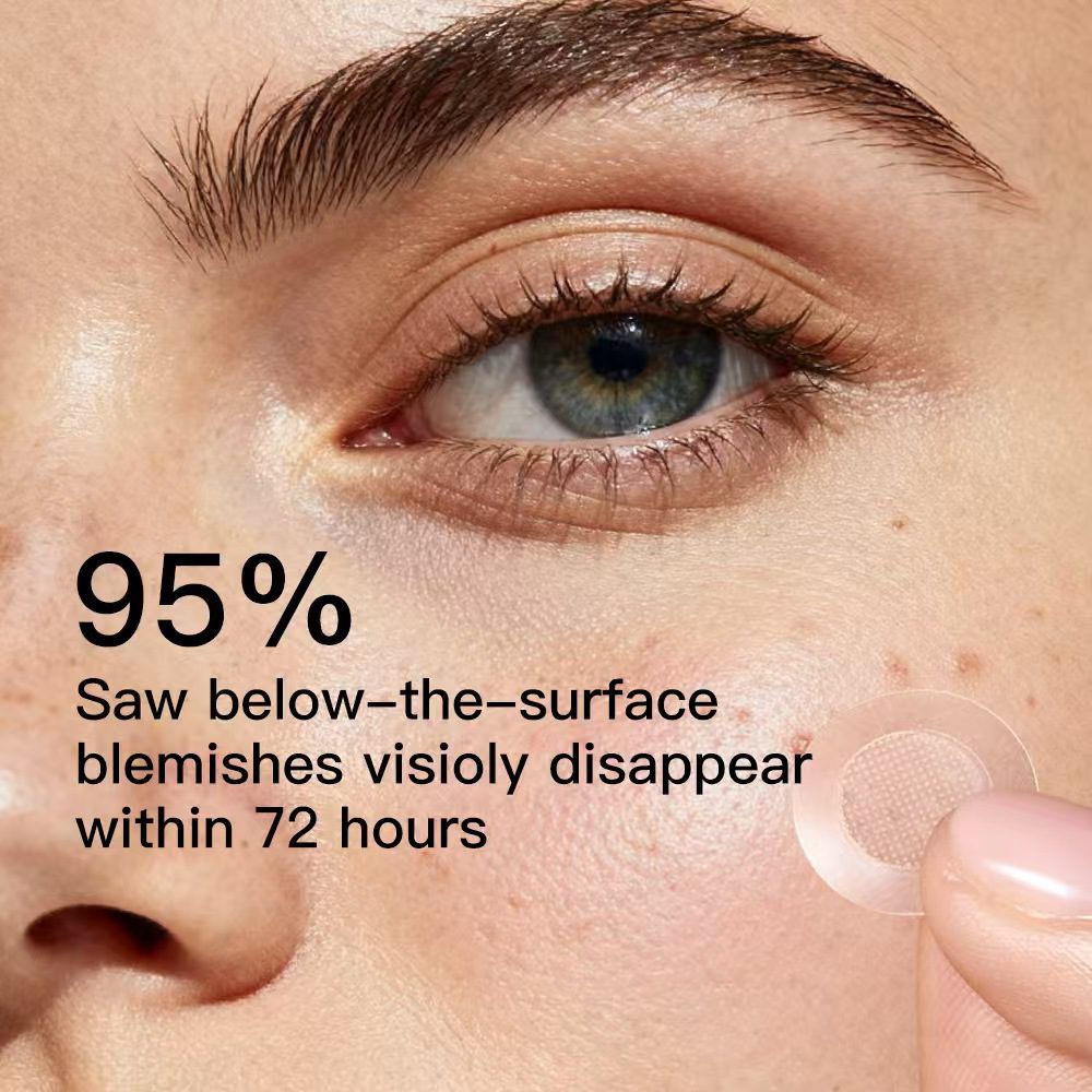 Private Logo Microneedle Acne Spot Patch with Active Ingredients OEM - Image 2